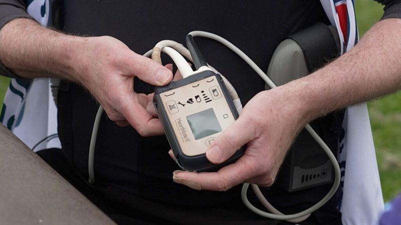 lvad
