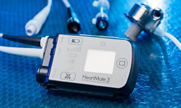 lvad